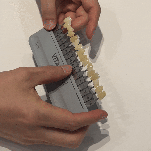 자가치아미백? 이것만으로는 어려운 이유 관련 이미지 6