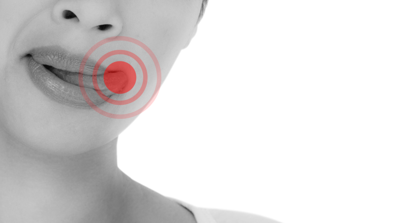 Tongue Tip Pain and Tongue Root Pain: Dentists Suspect Different Causes Depending on the Location image 3