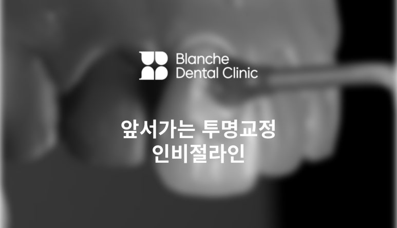 일반 투명교정 대신 인비절라인 하세요! 관련 이미지 1