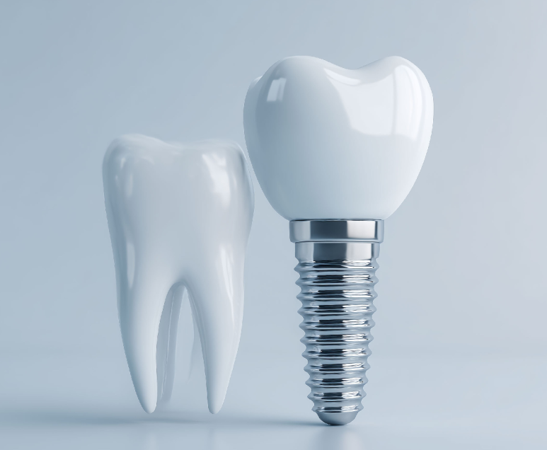 Banpo Dental Clinic: Which Crown Material Is Best Before Getting a Crown? image 2