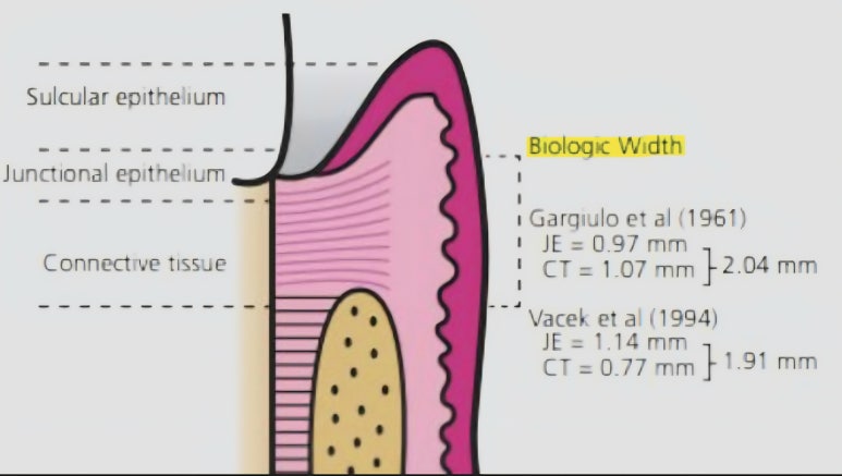 무삭제라미네이트 비용에 관한 숨겨진 진실, 모두 공개합니다. 관련 이미지 14