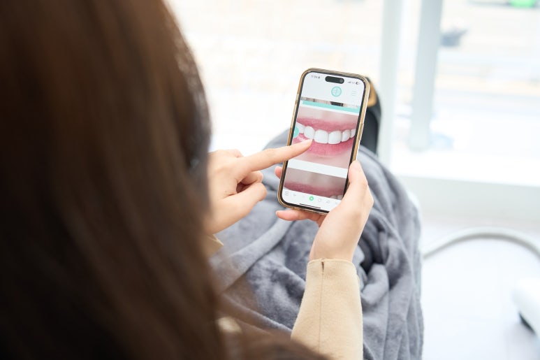 치아 무삭제 라미네이트? 부작용이 걱정이라면 이건 꼭 보고 가세요 관련 이미지 3