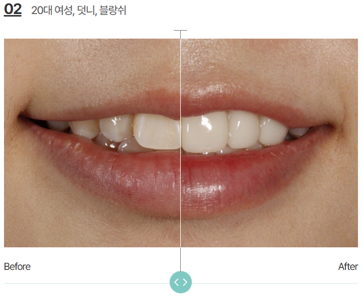 블랑쉬 라미네이트, 가격 속에 숨겨진 3가지 비밀 관련 이미지 11