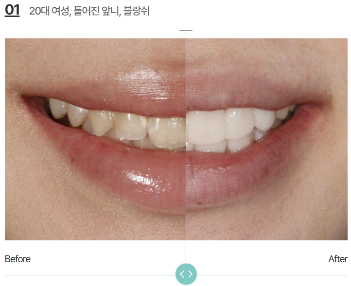 블랑쉬 라미네이트, 가격 속에 숨겨진 3가지 비밀 관련 이미지 10