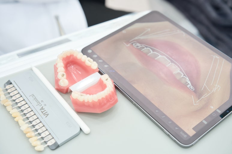 블랑쉬와 멜로망스 정동환님이 만났습니다. 관련 이미지 4