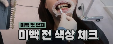 치아미백 시술,  시간과 가격 한계점까지 알려드립니다. 관련 이미지 4