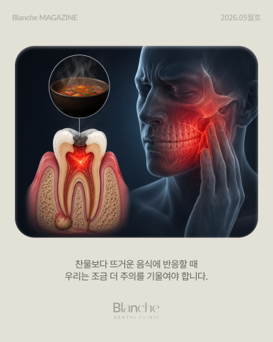 신경 치료, 아프면 무조건 해야 할까요? 자가 체크 가이드 관련 이미지 8