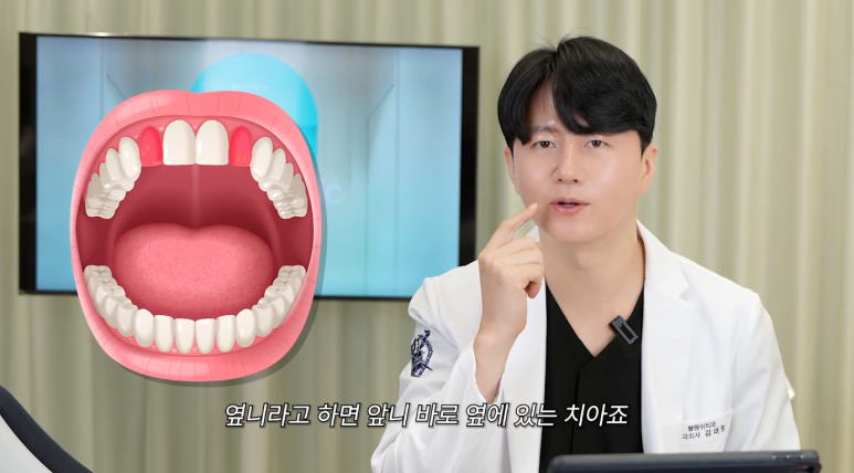 왜소치 치아교정 임플란트 고민이라면 관련 이미지 4