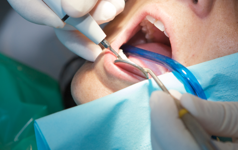 충치 신경치료 비용 건강보험 되는 경우 안 되는 경우 관련 이미지 6