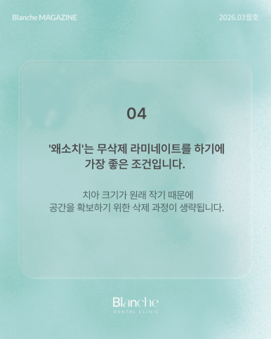 유독 작은 옆니(왜소치), 깎지 않고 예뻐질 수 있을까? 관련 이미지 7