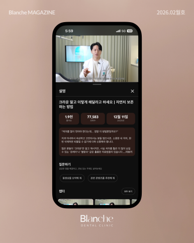 충치 치료, 무조건 깎아서 씌워야 할까? 관련 이미지 16