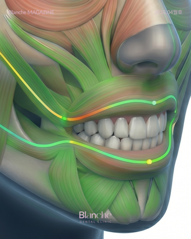Worried About Gums Showing When You Smile? image 14