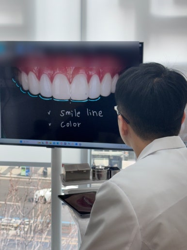 앞니라미네이트 부작용, 어떤 문제들이 생길 수 있을까요? 관련 이미지 2