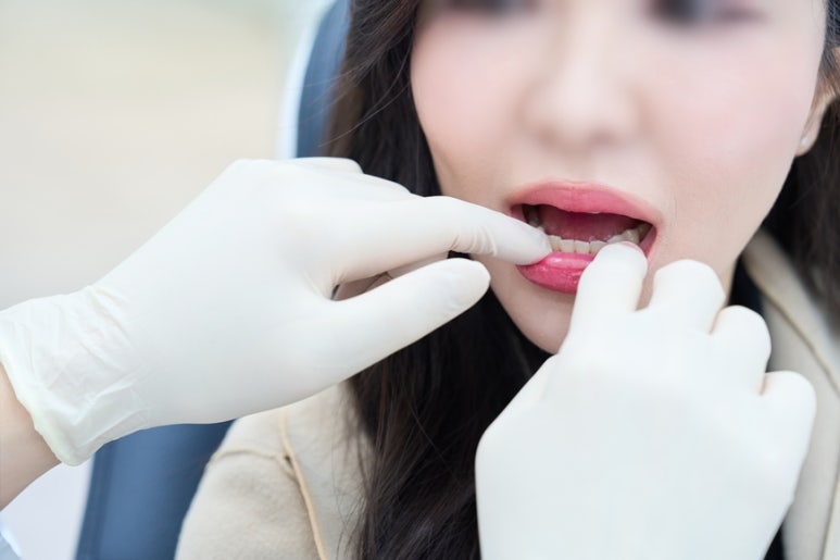 무삭제 라미네이트 비용? 선택하기 전 꼭 알아야 할 3가지<치과의사의 조언> 관련 이미지 4