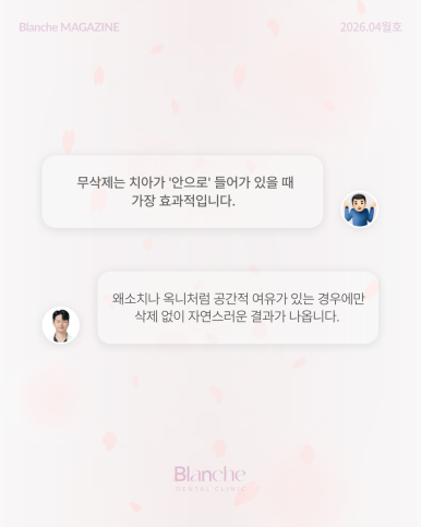 무삭제 라미네이트? 누구나 할 수 없는 진짜 이유 관련 이미지 6