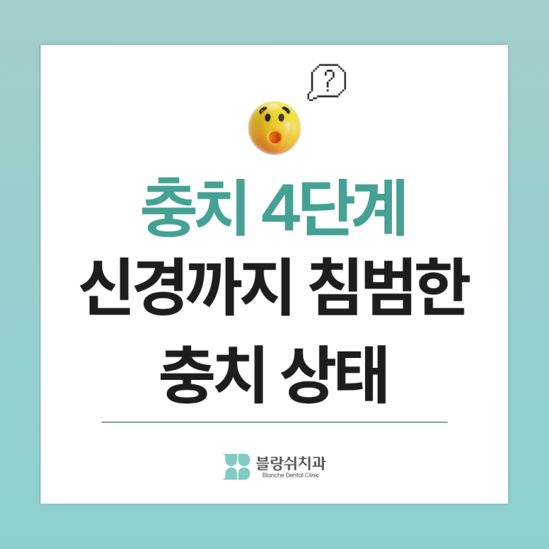 어린이 충치치료, 신경치료 안 가는 골든타임과 치료법 정리 관련 이미지 5