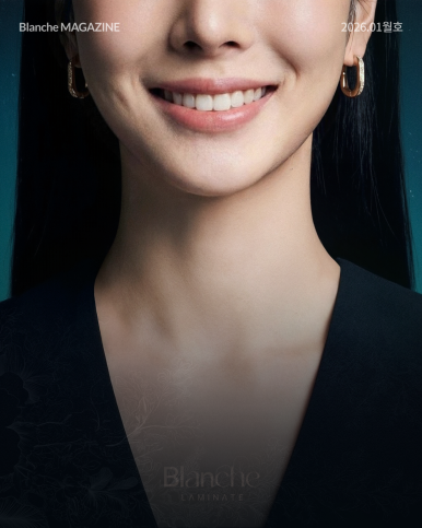 무삭제 라미네이트는 "부작용"이 없다? 관련 이미지 2