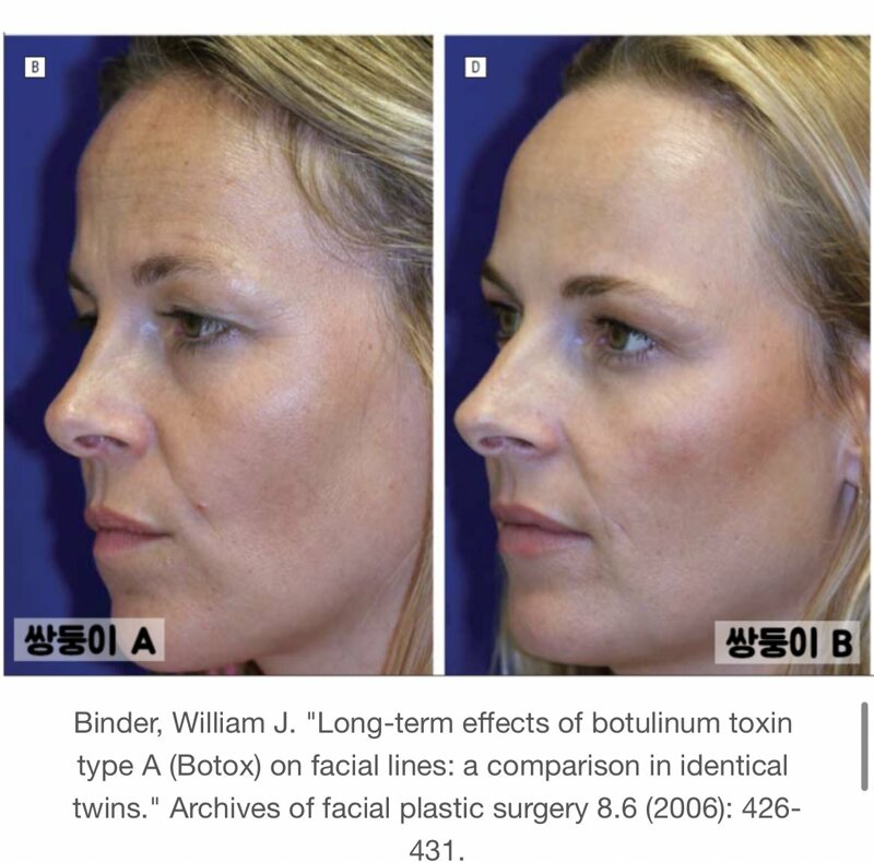 Robae Clinic) The secret to celebrities’ glowing skin? Skin Botox effects, duration, and cost-effectiveness image 4