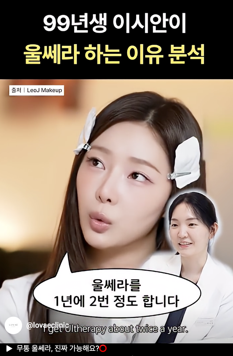 Ulthera at LSIAN | Do People in Their 20s Get Ulthera? | Hongdae Ulthera LOVAE Clinic image 2