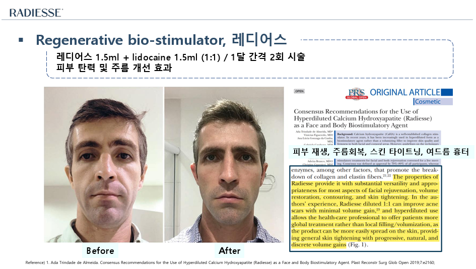 로바에의원) 콜라겐, 콜라겐..대체 뭐길래? 이렇게나 피부에 중요한 이유_홍대 레디어스 효과 관련 이미지 6