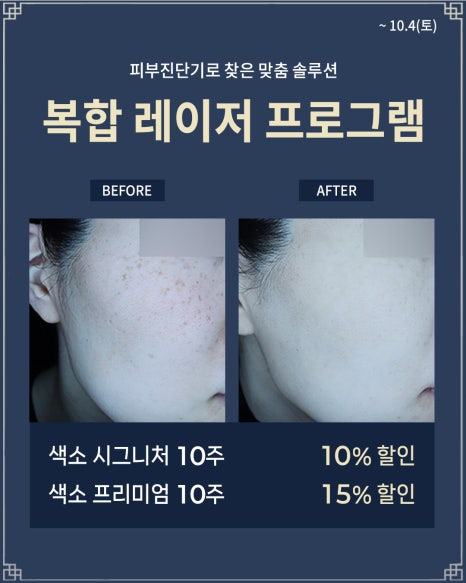 로바에 추석이벤트 | 추석 특별선물 할인 시술 알려드려요. 🫧 🍡 |홍대피부과이벤트 관련 이미지 4