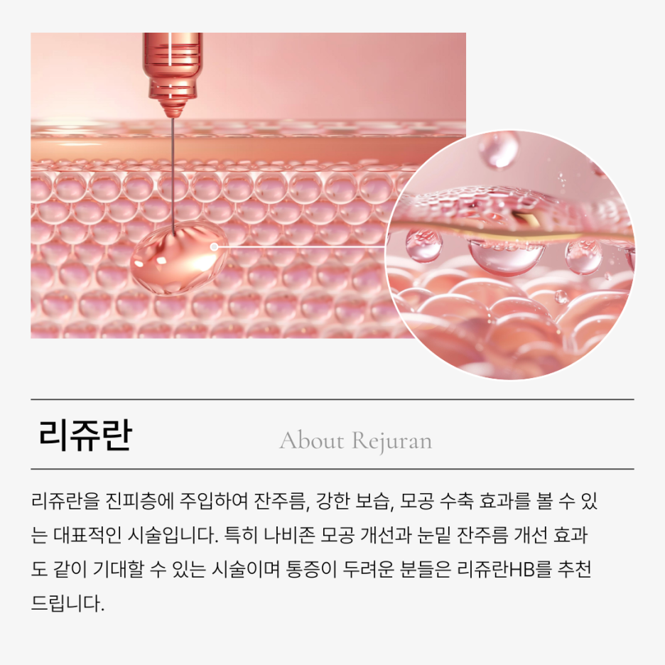 로바에의원) 홍대 리쥬란hb 리쥬란힐러 차이와 효과, 마취 통증 관련 이미지 4