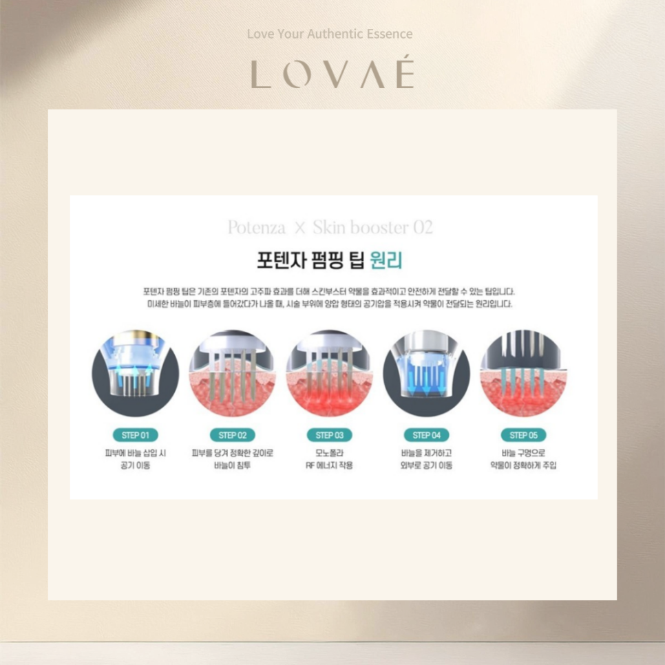 로바에의원 홍대본점) 엑소좀은 정말 여드름 흉터 색소침착 개선에 효과가 있을까? 관련 이미지 7