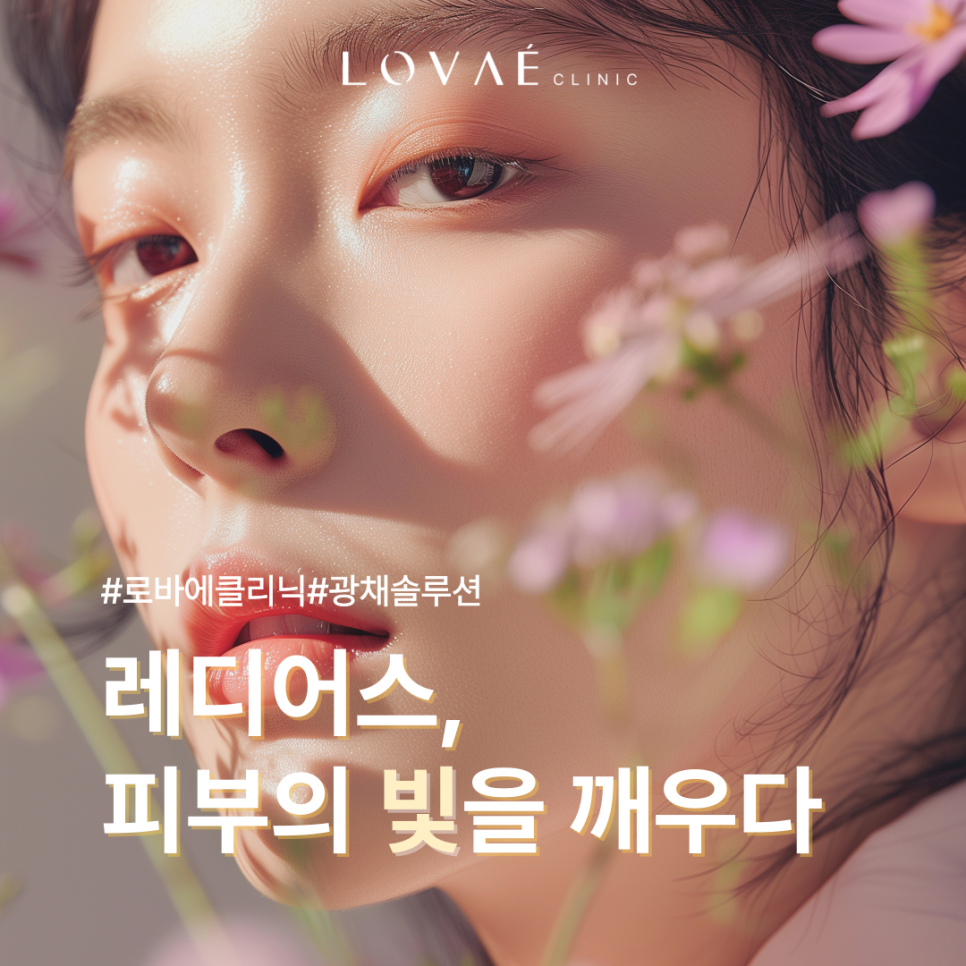 Radiesse Effects at Robae Clinic Hongdae: Nasolabial Folds, Collagen Formation, and Immediate Volume Restoration! image 1