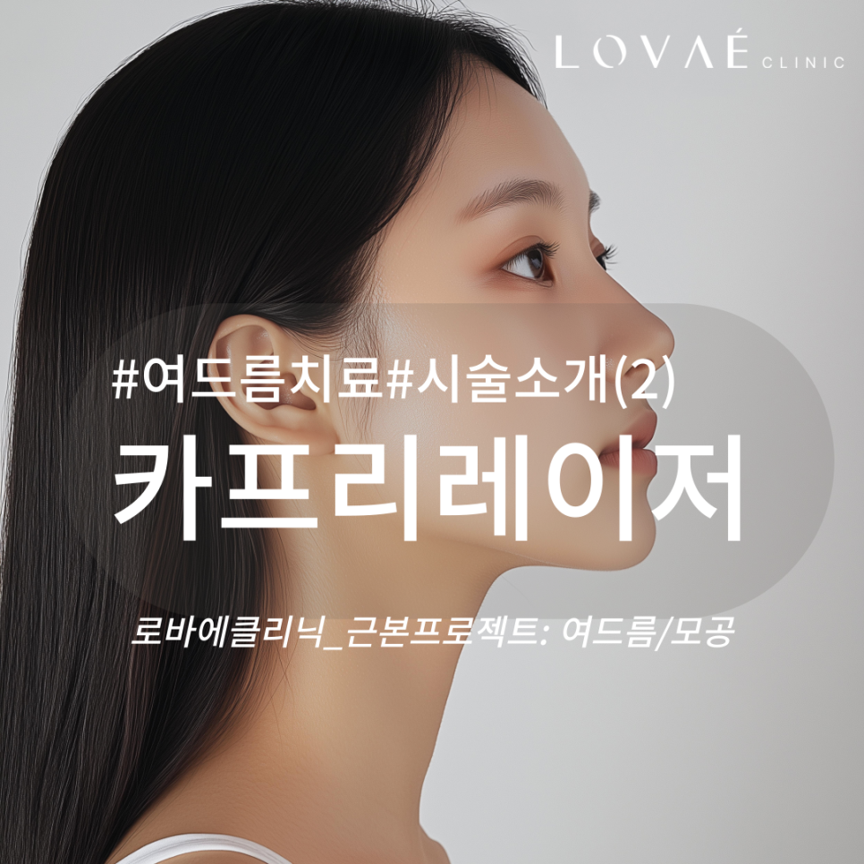 로바에의원) 홍대 여드름 치료 특화 카프리레이저 장점, 부작용, 가격까지 관련 이미지 2