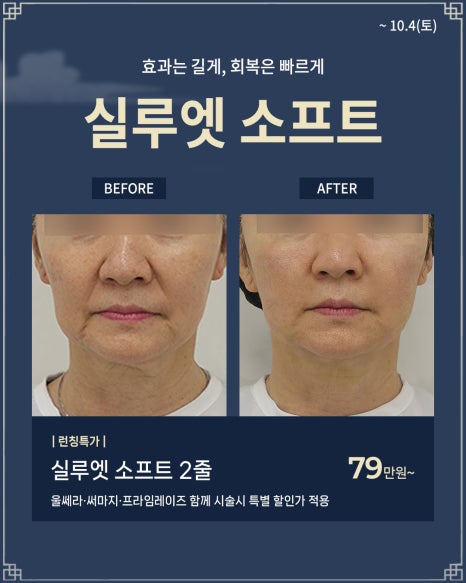 로바에 추석이벤트 | 추석 특별선물 할인 시술 알려드려요. 🫧 🍡 |홍대피부과이벤트 관련 이미지 3