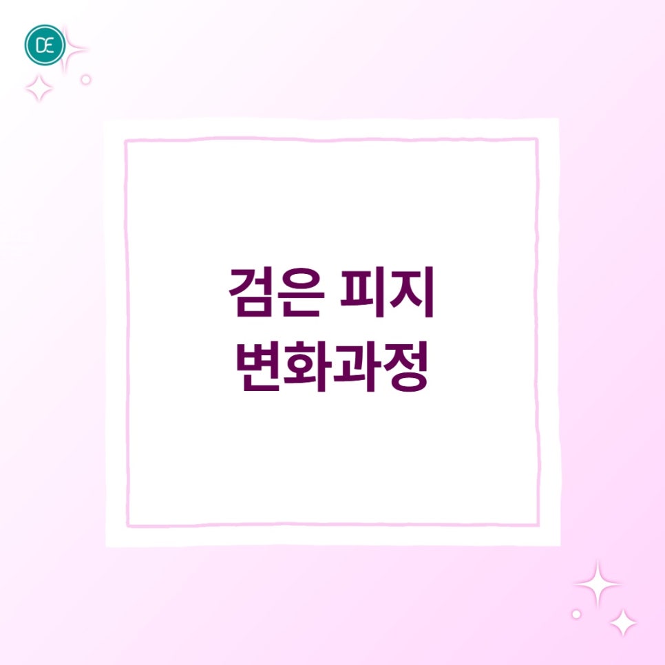 Ilsan Skincare: Managing Black Sebum on the Underarms and Back image 3