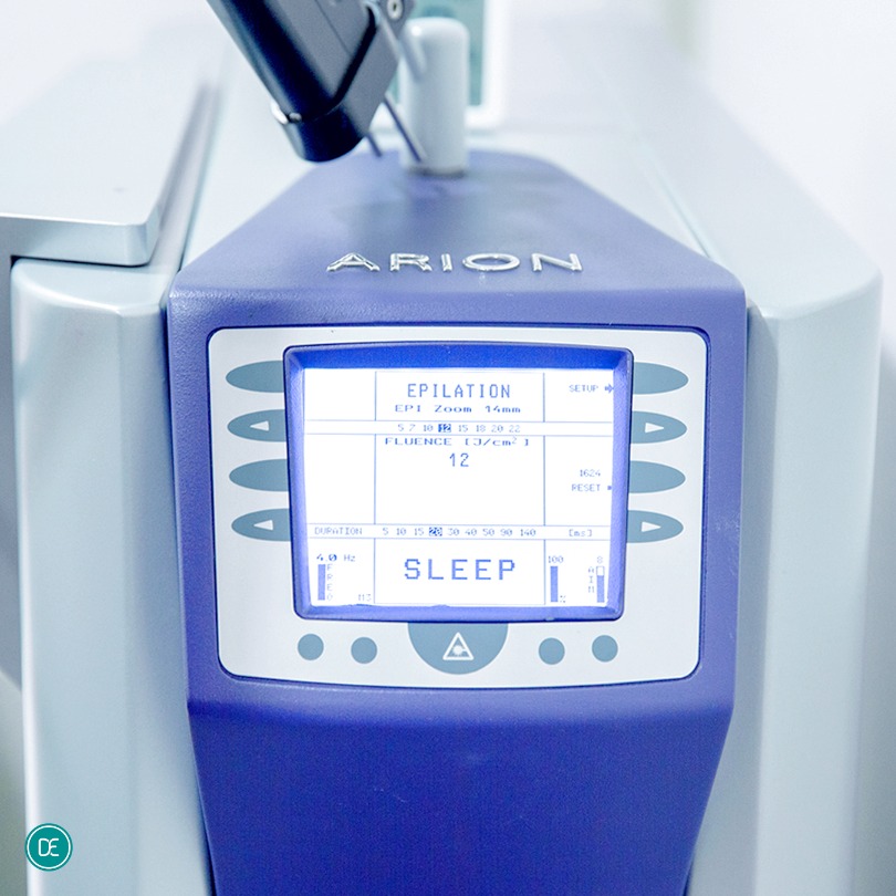 Why Women in Cheonan Choose Laser Hair Removal Instead of Eyebrow Razors for Upper Lip Hair image 4
