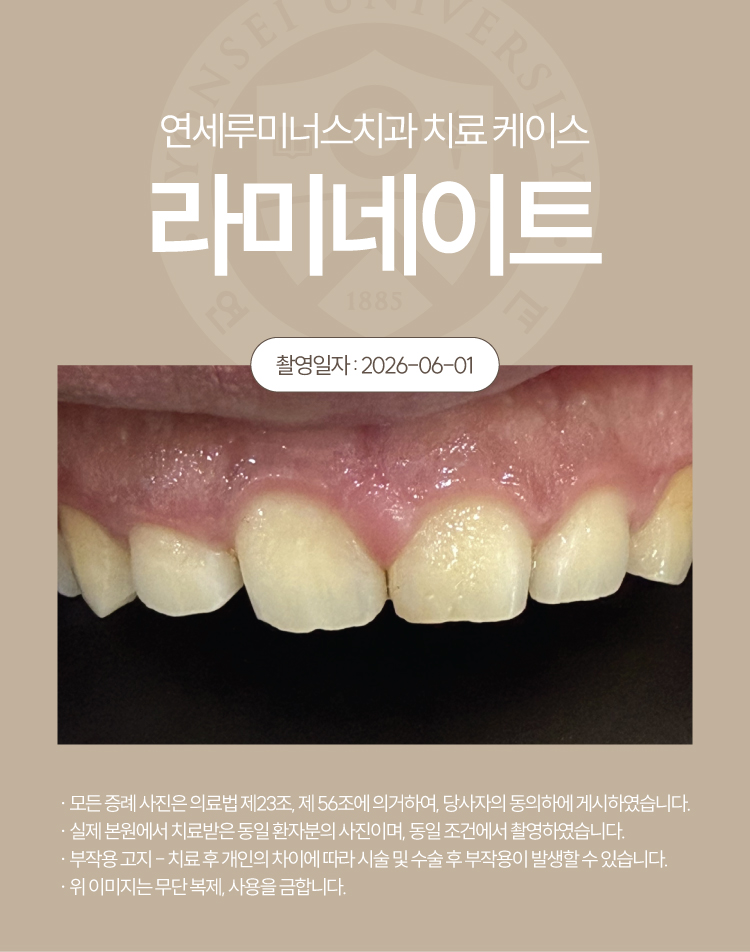 강남역라미네이트 수복증례 ― 치료 케이스 (31세/남환자) 관련 이미지 2