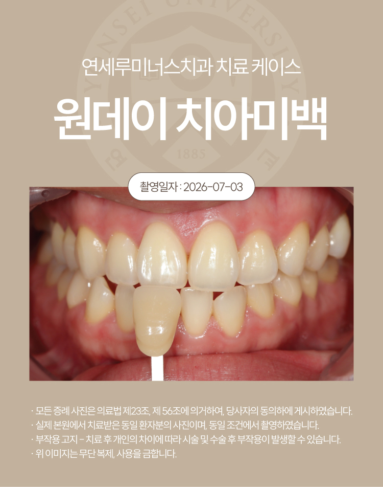 강남역원데이치아미백 치료사례 ― 원데이 치아미백 케이스 (27세/여환자) 관련 이미지 2