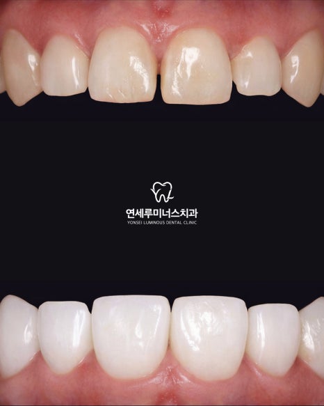 강남역치과 연세루미너스치과 원장이 솔직하게 말하는 진료 철학 이야기 관련 이미지 7