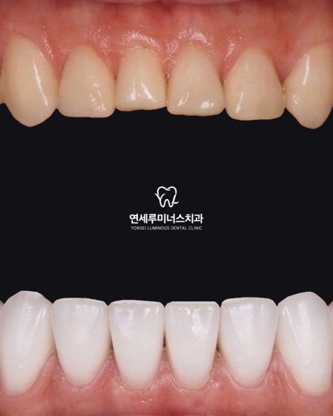 강남역치과 연세루미너스치과 원장이 솔직하게 말하는 진료 철학 이야기 관련 이미지 8