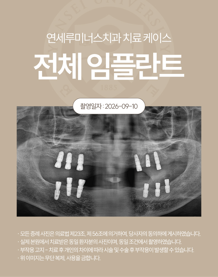 강남전체임플란트 케이스 : 제주도에서 찾아오신 무치악 환자, 당일 식립 완료 관련 이미지 6