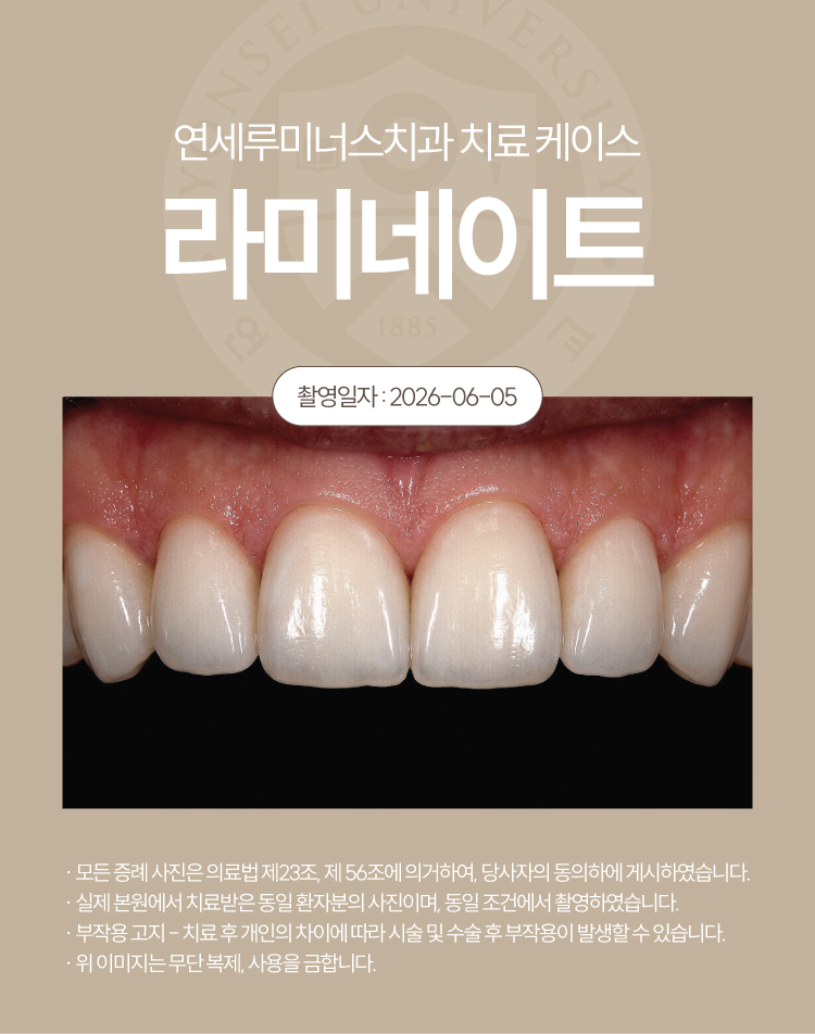 강남역라미네이트 수복증례 ― 치료 케이스 (31세/남환자) 관련 이미지 3