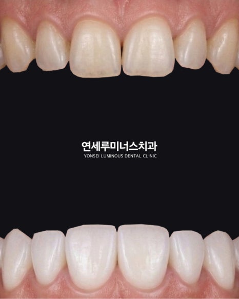 강남역치과 연세루미너스치과 원장이 솔직하게 말하는 진료 철학 이야기 관련 이미지 6