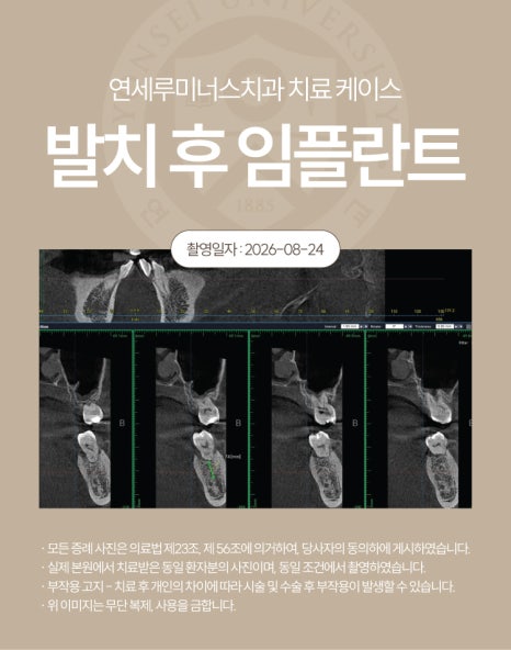 강남발치후임플란트 케이스 - 심한 치주질환으로 인한 발치 후 즉시 임플란트 (40대/남환자) 관련 이미지 5