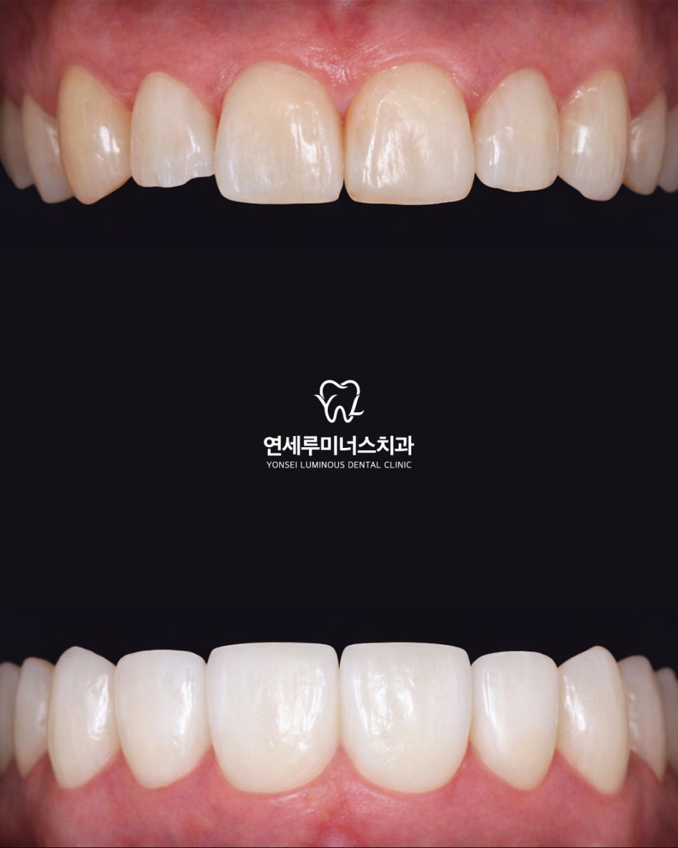 오늘도 새로운 라미네이트 관련 이미지 1