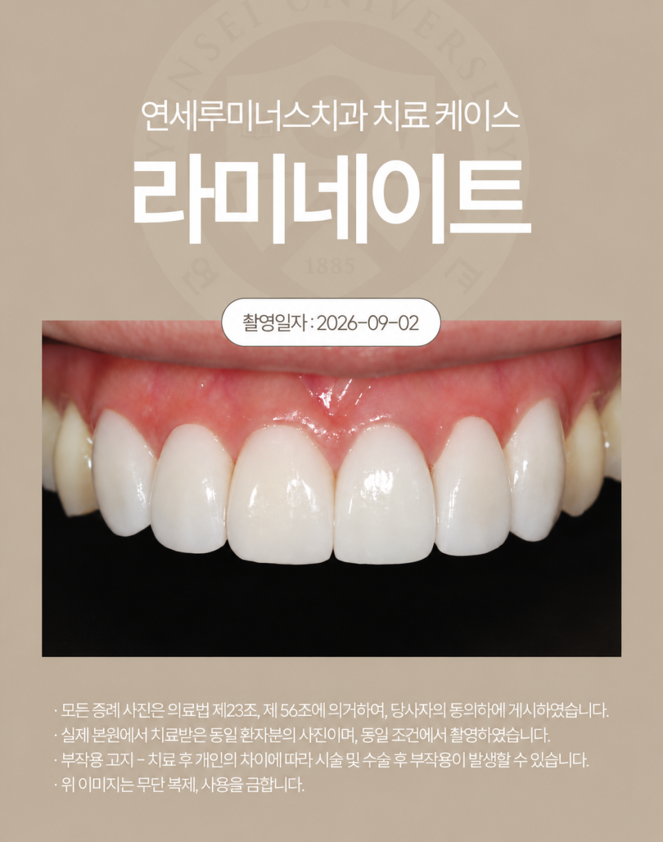 강남 라미네이트 / 깨진 앞니 고민을 자연스럽게 개선한 사례 관련 이미지 3