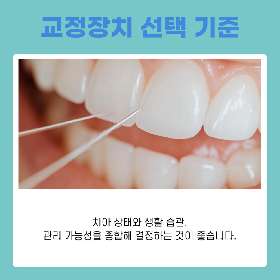 삼성동 교정치과 나에게 맞는 치료법 관련 이미지 10