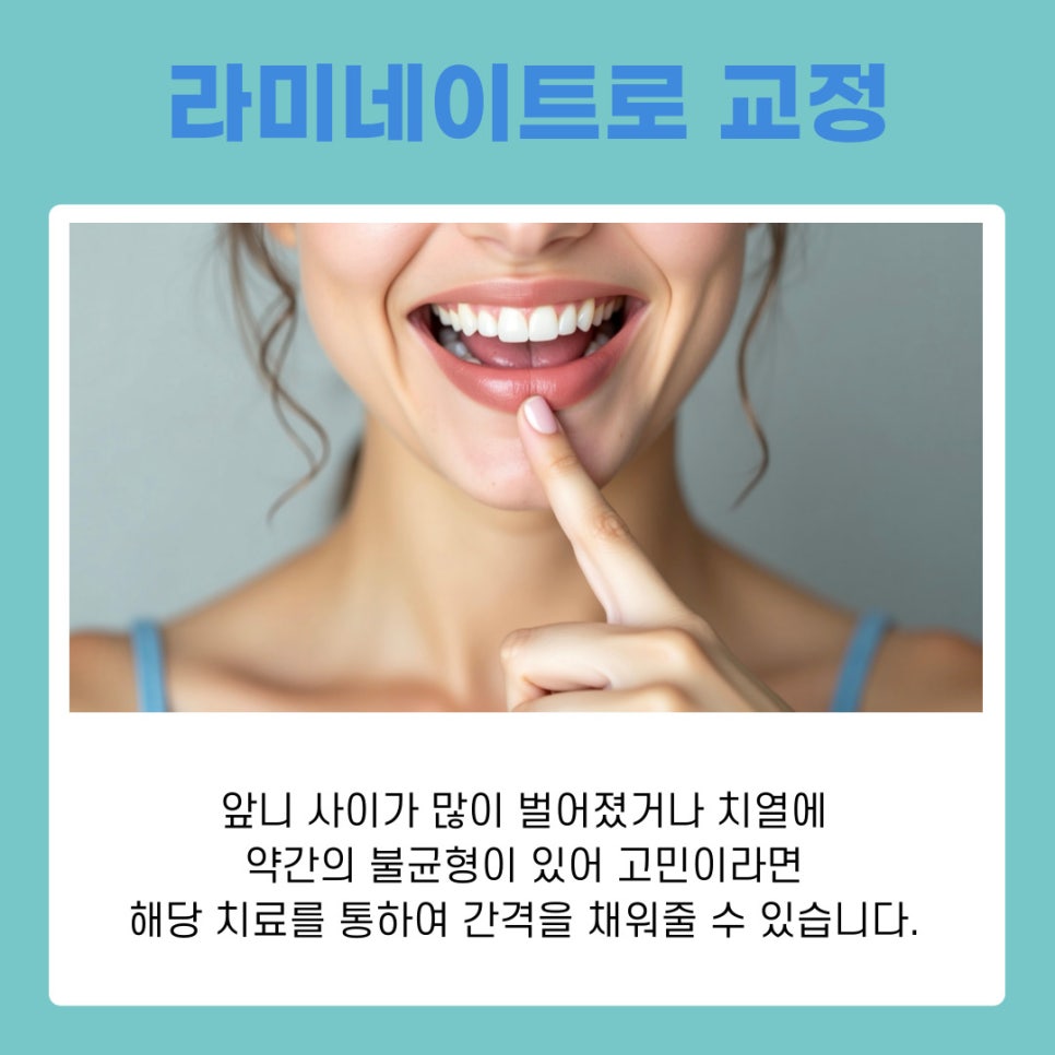 역삼동치과 라미네이트 하고 싶다면 어떤 점을 고려할까 관련 이미지 5