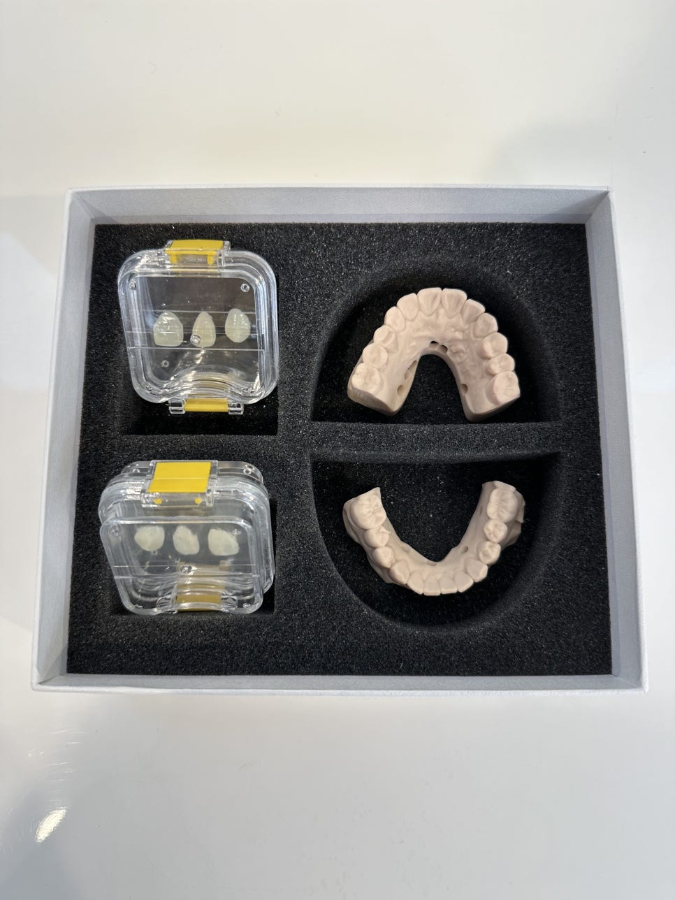 서초동라미네이트 치아를 아름답게 관련 이미지 8