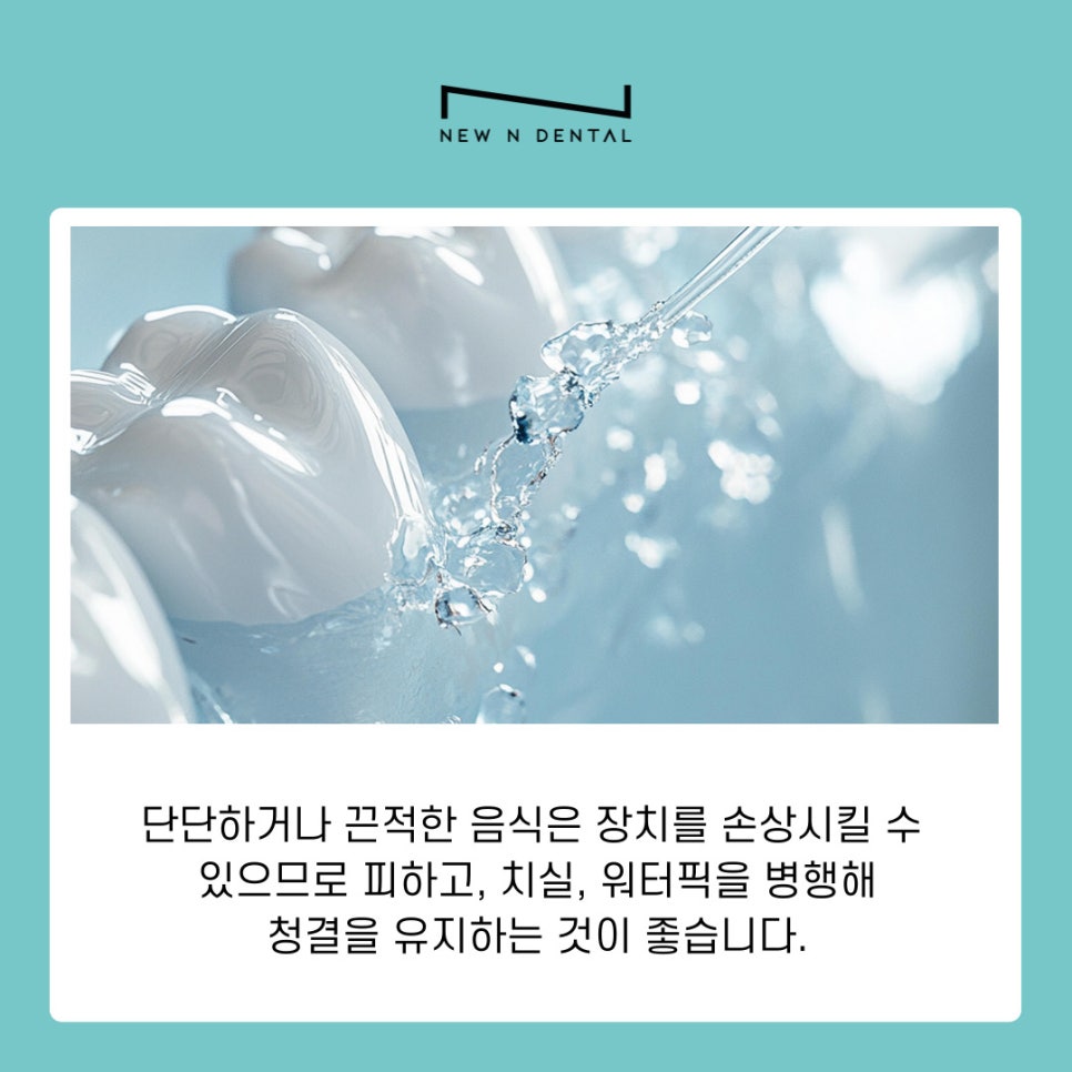 강남역교정치과 덧니발치교정 치아 건강과 심미성 모두 잡는 방법 관련 이미지 9