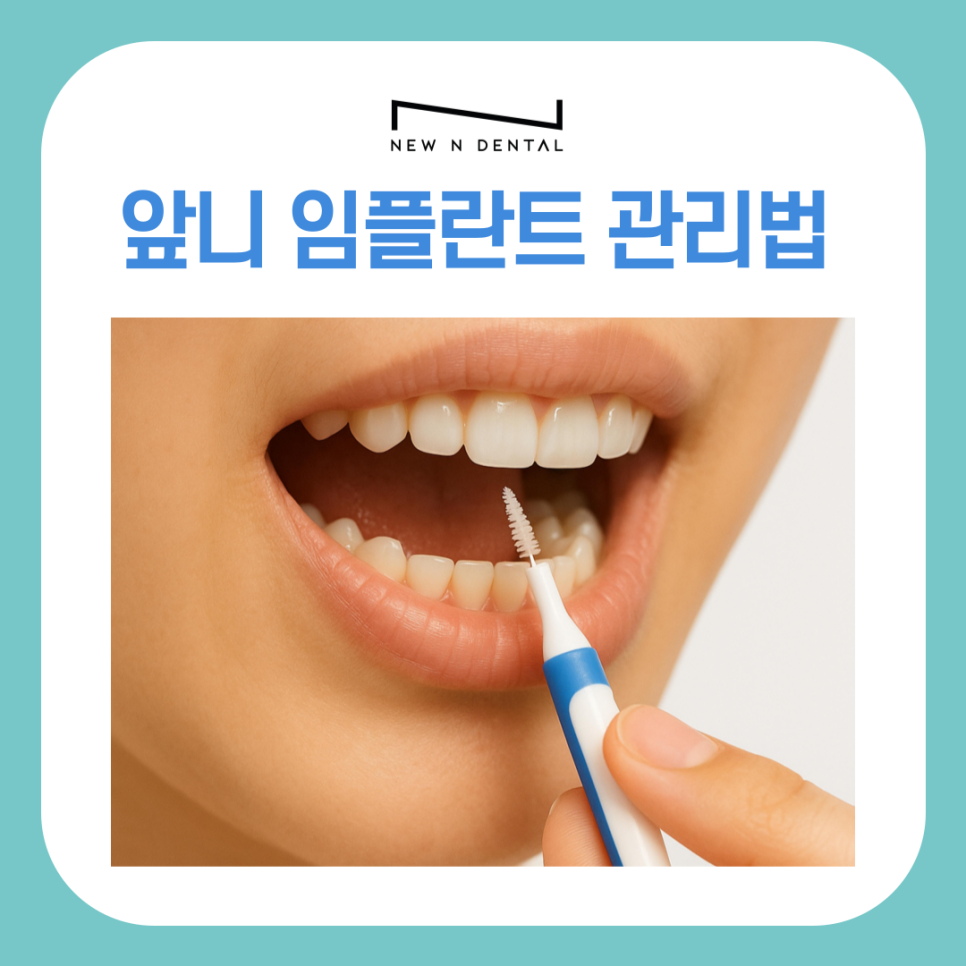 앞니 임플란트 식립 주의해야 할 사항은? 관련 이미지 10