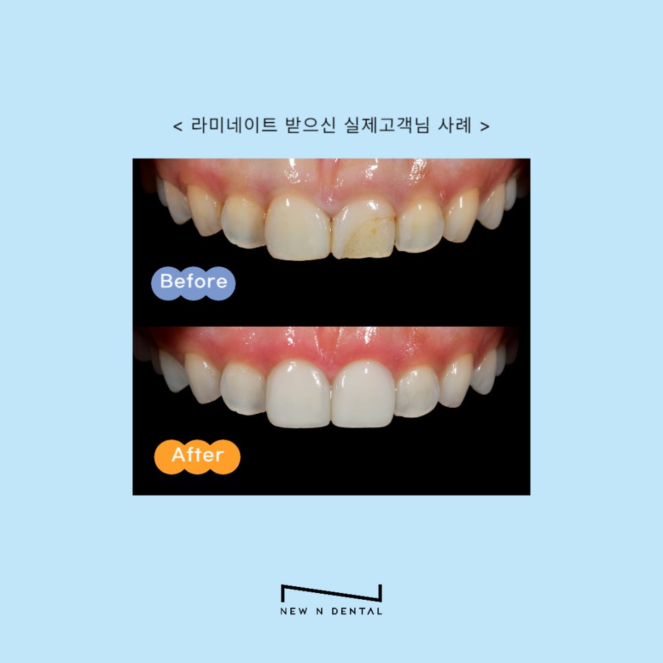 라미네이트 고민한다면 올바른 정보확인하기 관련 이미지 17