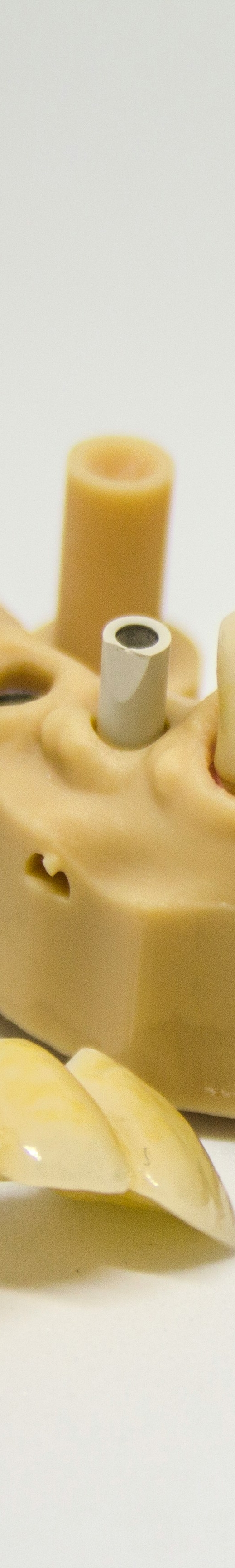 임플란트 후 관리의 중요성 관련 이미지 21