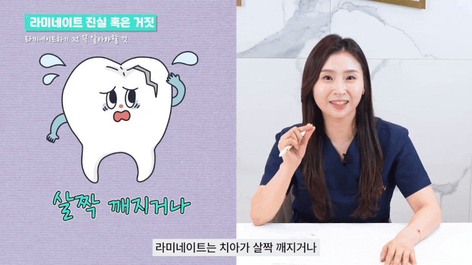 강남라미네이트 치료에 관한 심층적 이해와 고려 사항 관련 이미지 6